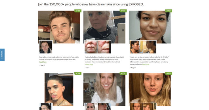 Exposed Skin Care website image